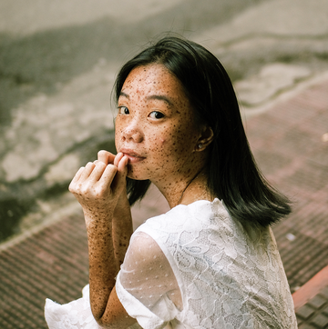 how to get rid of a pimple fast how to get rid of a pimple fast